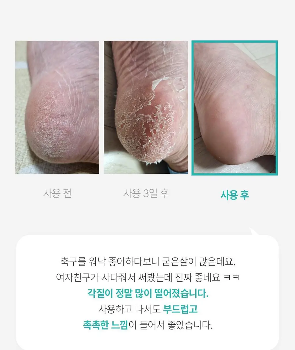 [발허물팩] 아리얼 스무스 앤 퓨어 풋 필링 마스크 2입 7종 택1 상세페이지 28